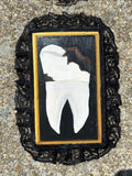 Small Human Tooth with Cavities Original Painting